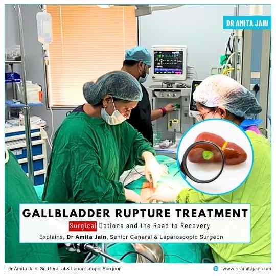 Dr Amita Jain Sr. General & Laparoscopic Surgeon for gallbladder surgery in delhi ncr