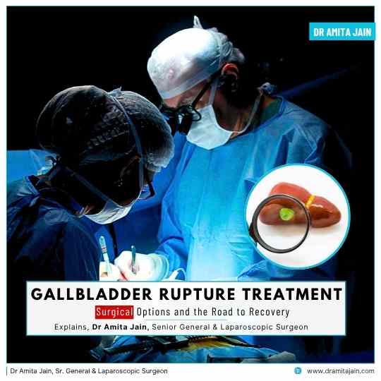 Dr Amita Jain Sr. General & Laparoscopic Surgeon for gallbldder surgery in delhi