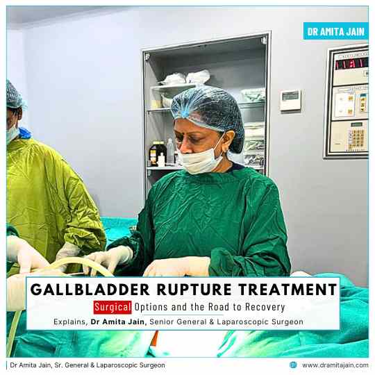 Dr Amita Jain Sr. General & Laparoscopic Surgeon gallbladders specialist in delhi