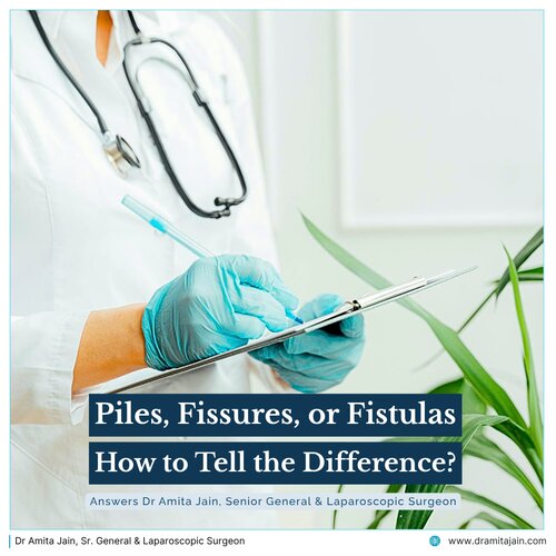 dr amita jain best surgeon for piles, fissure, fistula in india