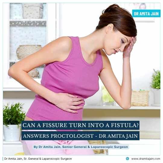 Can a Fissure Turn Into a Fistula Answers Proctologist Dr Amita Jain