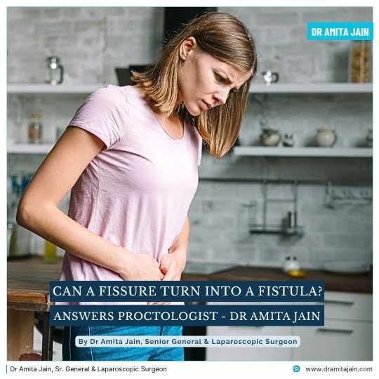 Can a Fissure Turn Into a Fistula Answers Proctologist Dr Amita Jain