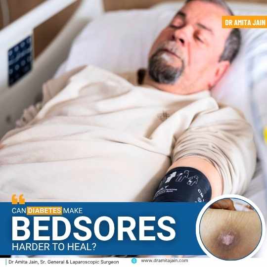 Dr Amita Jain 2026_best specialist for bed sores in delhi ncr