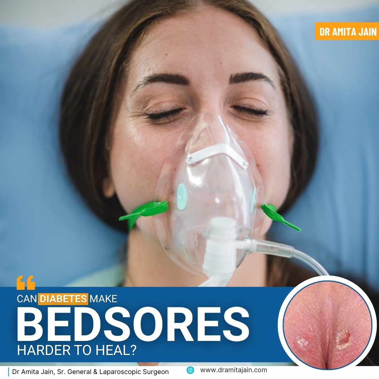 Dr Amita Jain_best bed sores surgeon in delhi