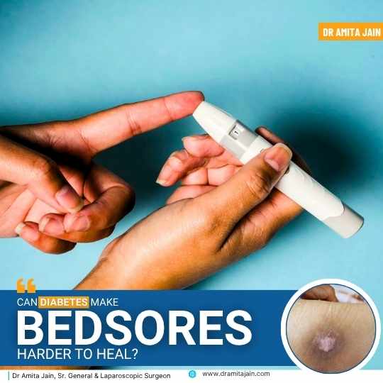 Dr Amita Jain_best surgeon for bed sores in Delhi