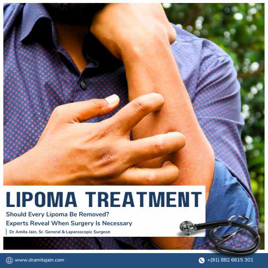 Lipoma treatment surgery in Delhi by Dr Amita Jain