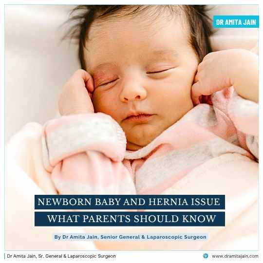 New born baby and hernia issue treatment Dr Amita Jain Sr General Surgeon