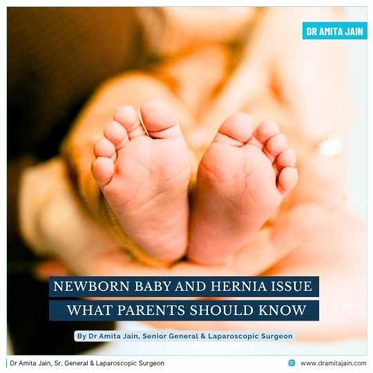 New born baby and hernia issue treatment Dr Amita Jain Sr General Surgeon