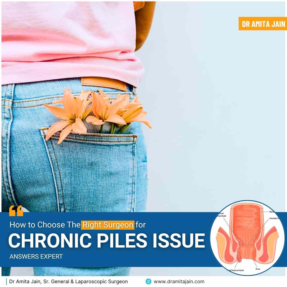 Dr Amita Jain Sr. Proctologist in Delhi on how to choose the right surgeon for chronic piles issue