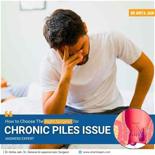 Dr Amita Jain Sr. Proctologist in Delhi on how to choose the right surgeon for chronic piles issue