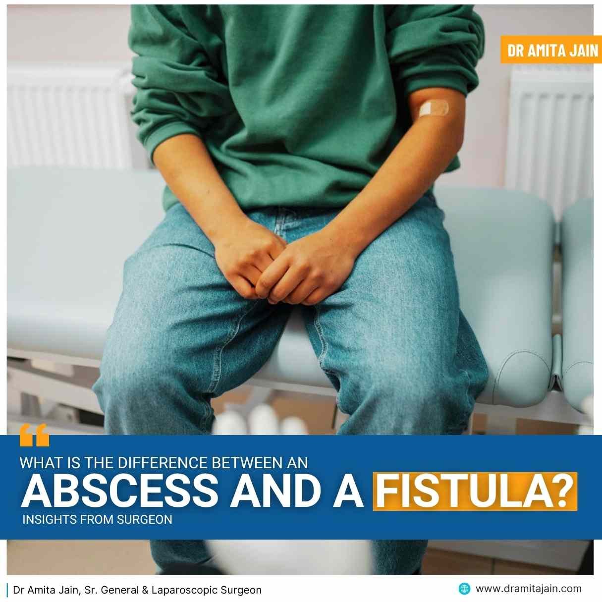 What Is the Difference Between an Abscess and a Fistula?
