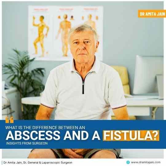 What Is the Difference Between an Abscess and a Fistula?