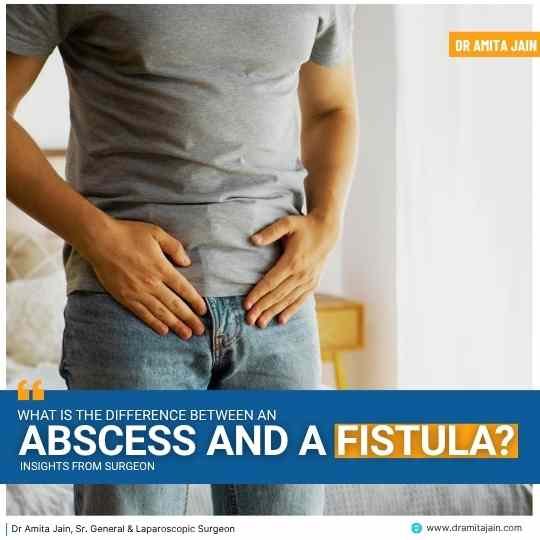 What Is the Difference Between an Abscess and a Fistula?