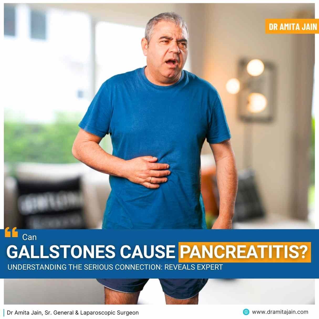 Can Gallstones Cause Pancreatitis? Understanding the Serious Connection: Reveals Expert