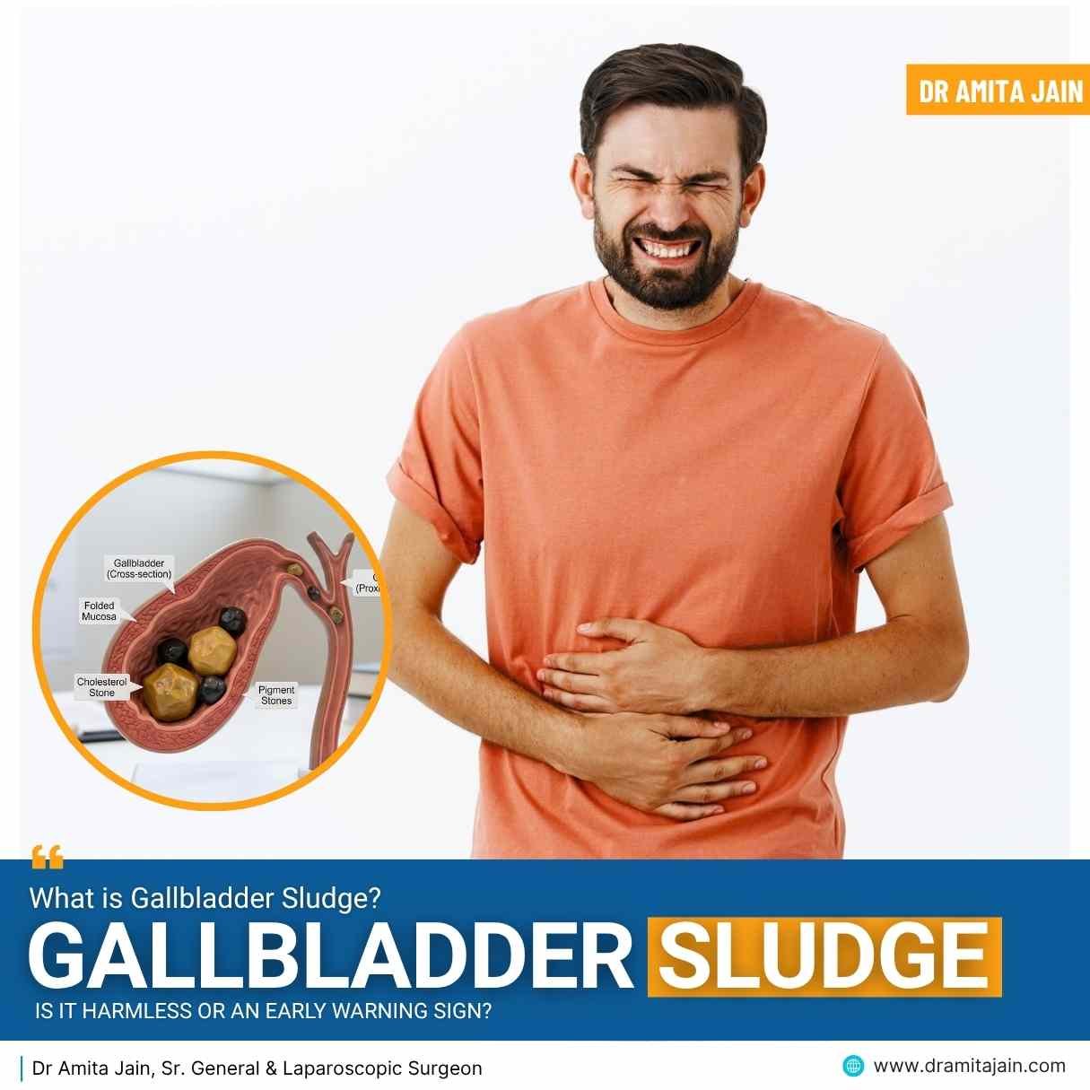 What Is Gallbladder Sludge: Is It Harmless or an Early Warning Sign?