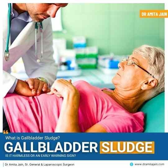What Is Gallbladder Sludge: Is It Harmless or an Early Warning Sign?