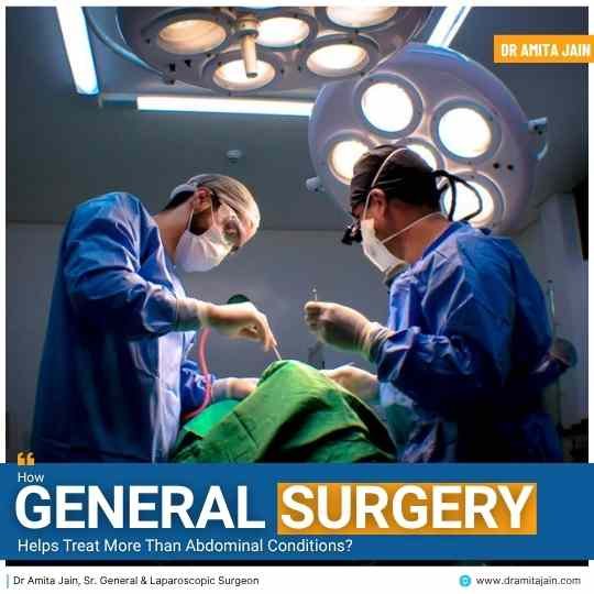 How General Surgery Helps Treat More Than Abdominal Conditions
