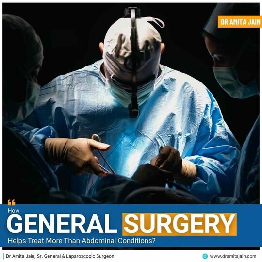 How General Surgery Helps Treat More Than Abdominal Conditions