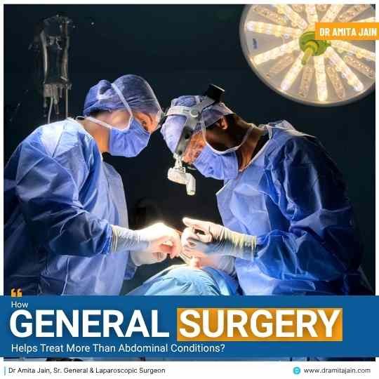 How General Surgery Helps Treat More Than Abdominal Conditions