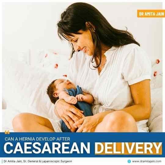 Post pregnancy Hernia treatment by Dr Amita Jain