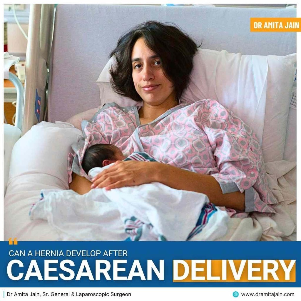 Post pregnancy Hernia treatment by Dr Amita Jain
