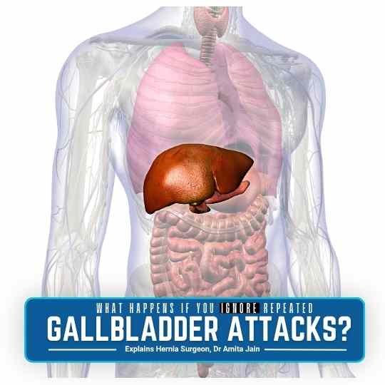 What Happens If You Ignore Repeated Gallbladder Attacks?