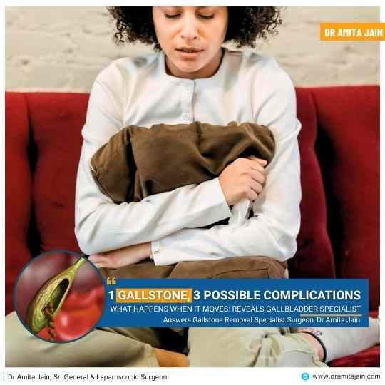 gallstone removal surgery insight by Dr Amita Jain
