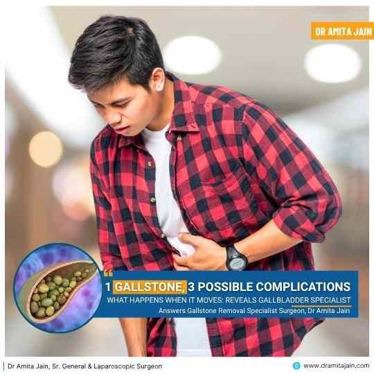 gallstone removal surgery insight by Dr Amita Jain